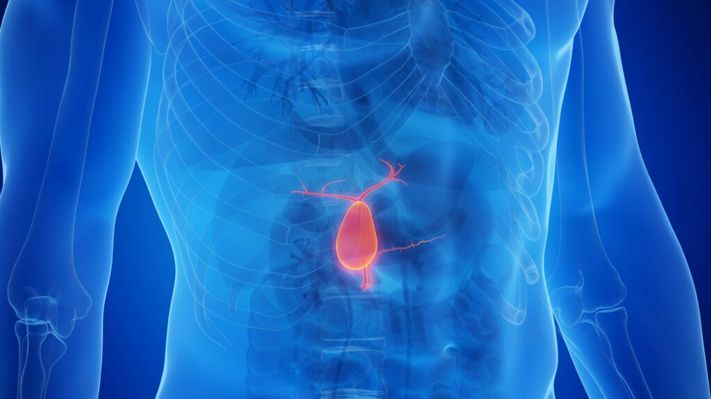 L’ablation de la vésicule biliaire des conséquences sur l