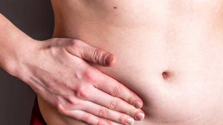 Comment sont traitées les différentes hernies abdominales ? | Dr Servajean | Paris