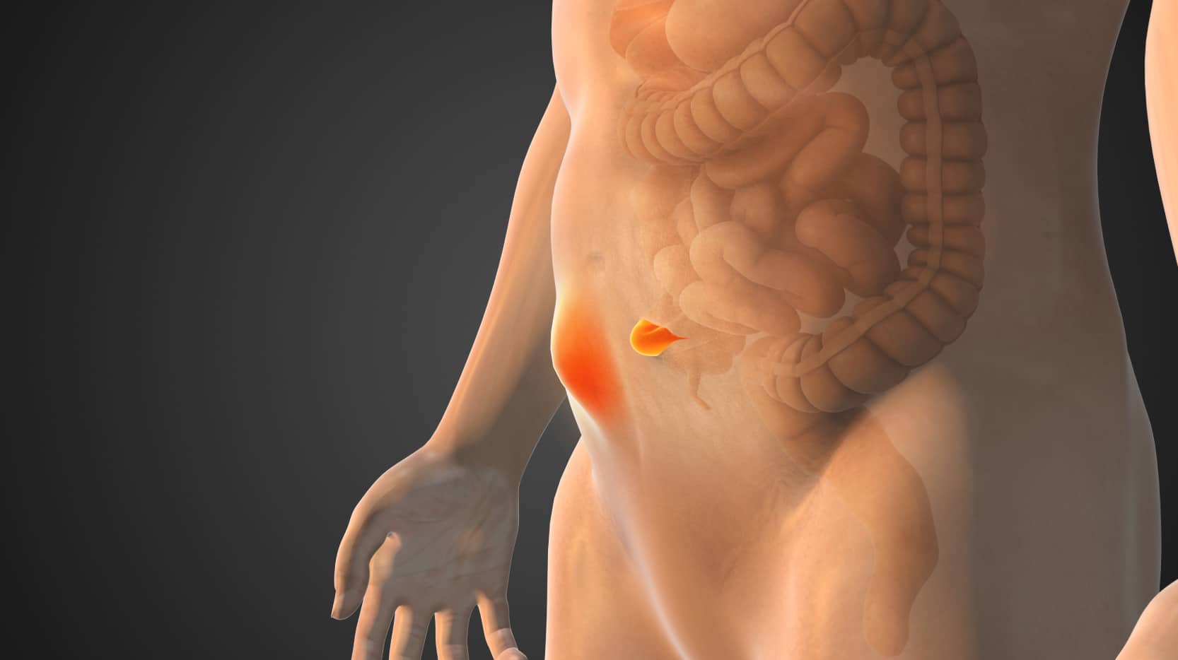 Hernie ombilicale adulte traitement naturel chirurgie | Dr Stéphane Servajean | Paris